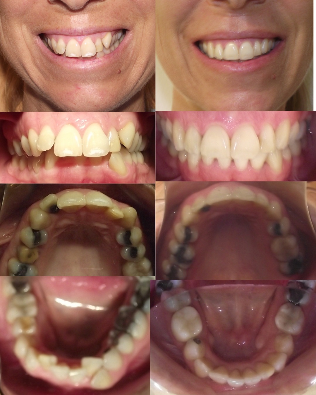 Dental transformation 1