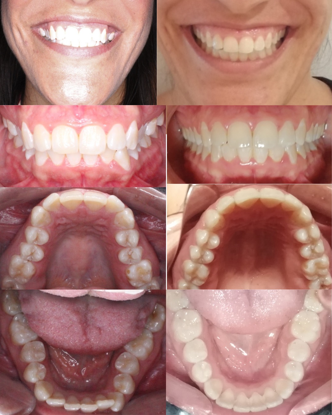 Dental transformation 10