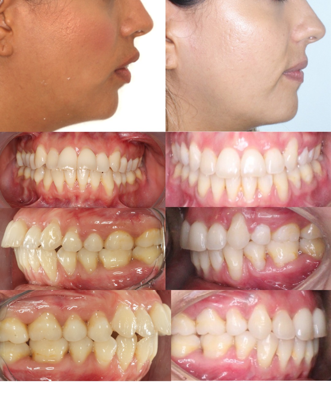 Dental transformation 11