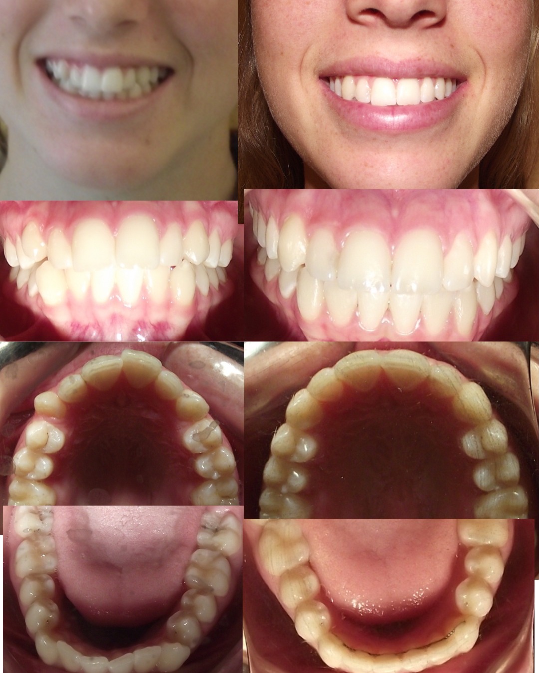 Dental transformation 12