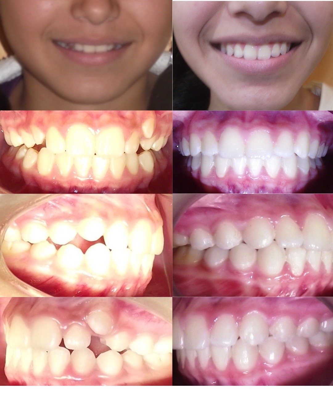 Dental transformation 2