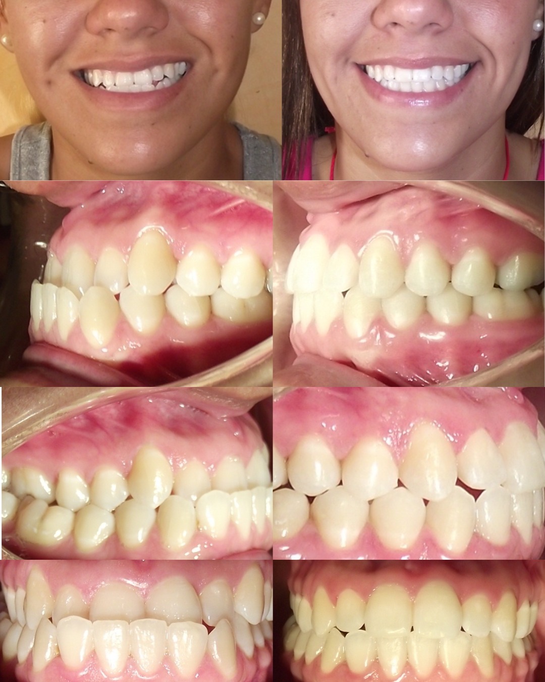 Dental transformation 3
