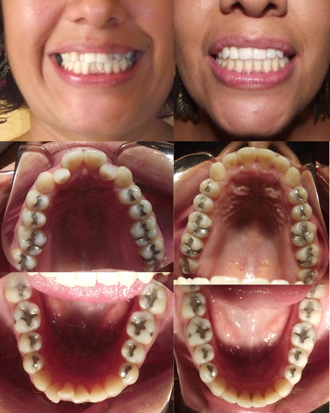Dental transformation 4