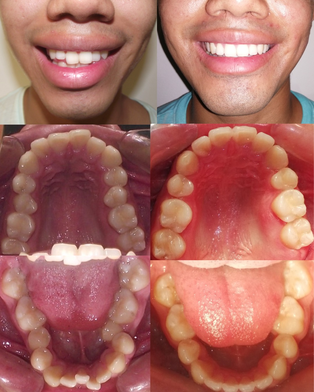 Dental transformation 5