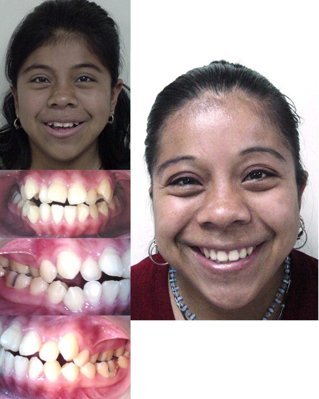 Dental transformation 6