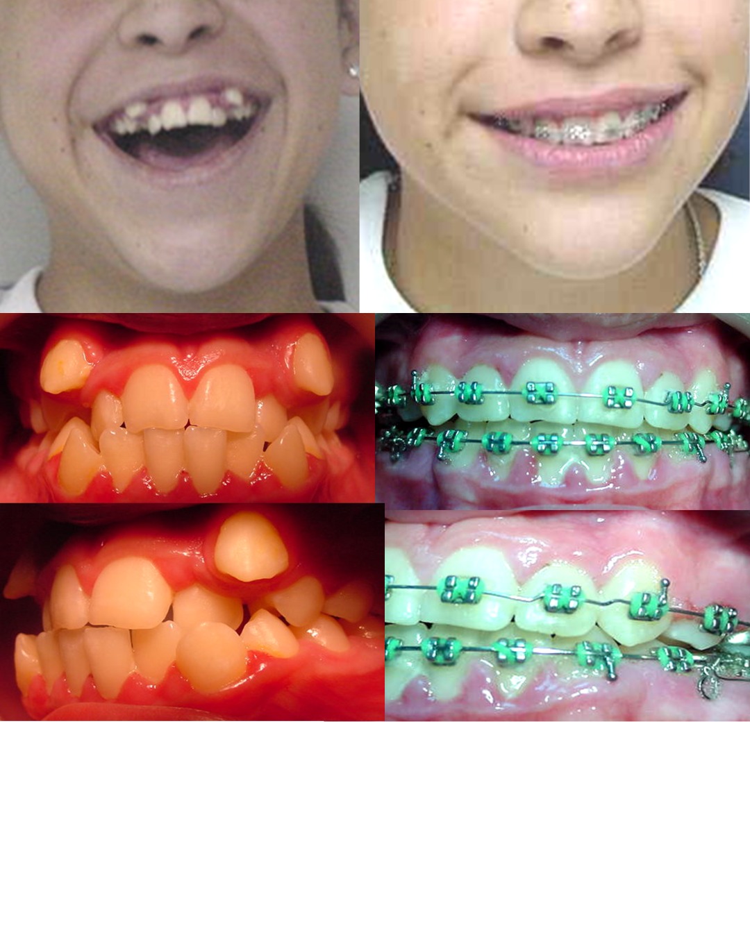 Dental transformation 7