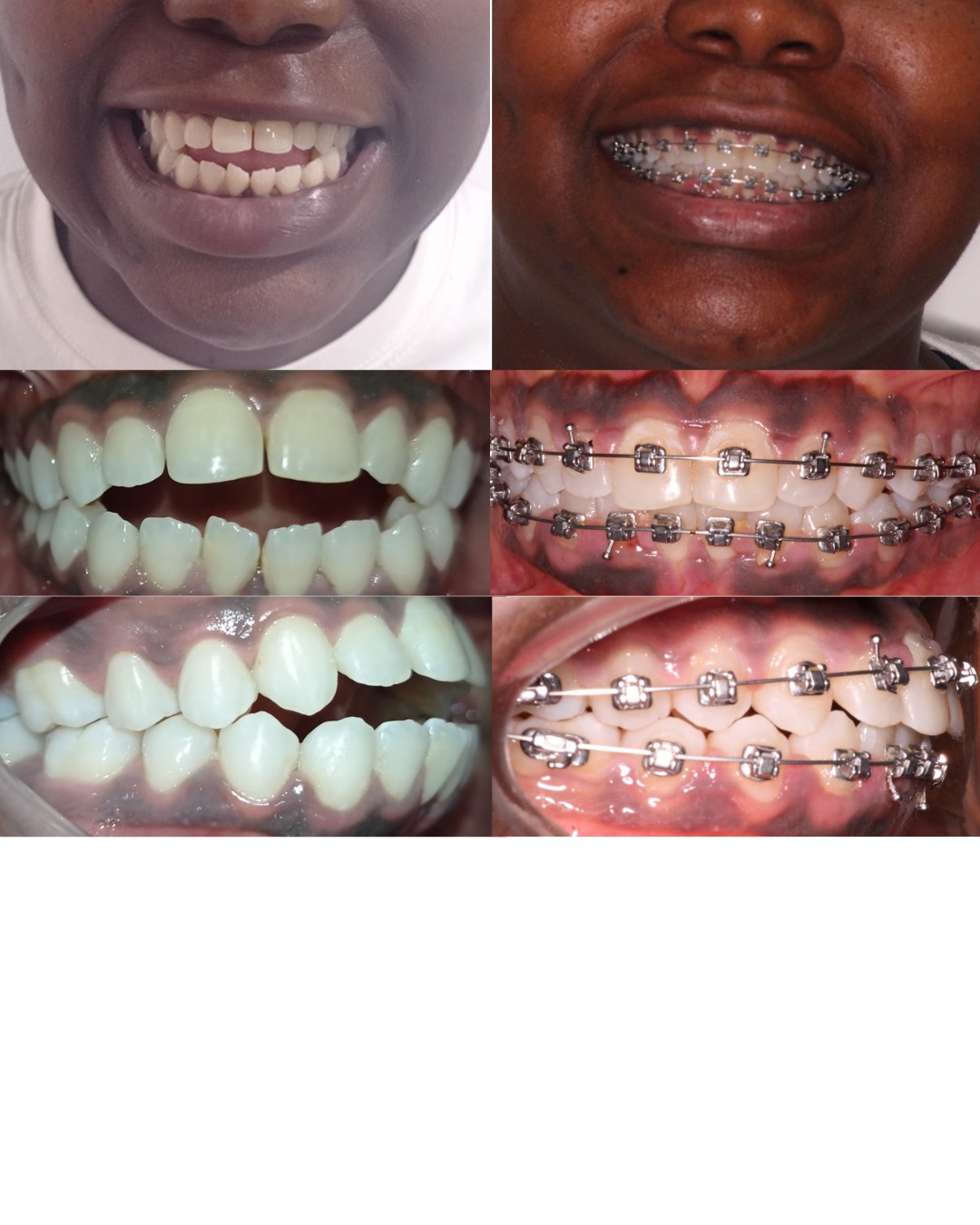 Dental transformation 8