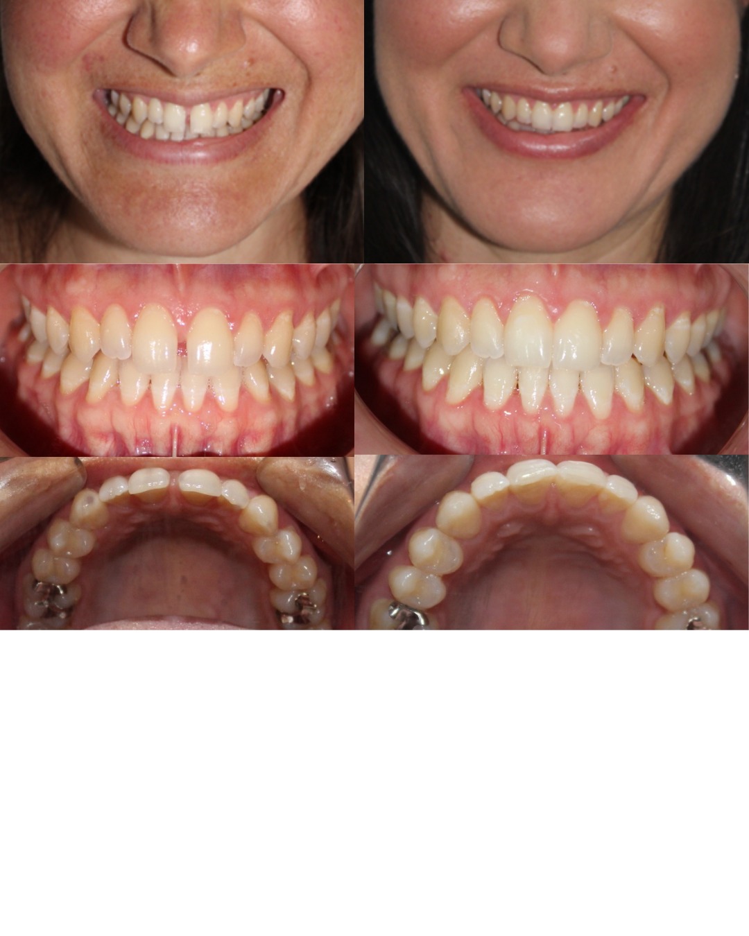 Dental transformation 9